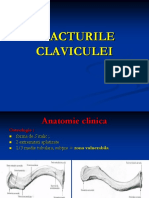 07.FRACTURILE CLAVICULEI .ppt