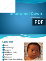 Sindromul Down