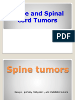 Metastatic Tumor of Spine-1