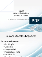 Lesiones Focales de Hígado PDF