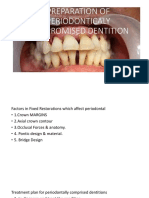 Preparation and Treatment of Periodontally Compromised Dentition