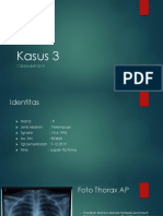 Kasus 3 MR Radio