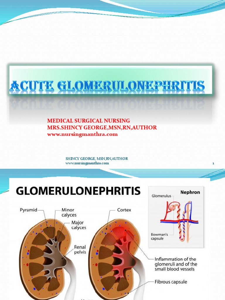 Acute Glomerulonephritis Overview | PDF | Kidney | Medical Specialties