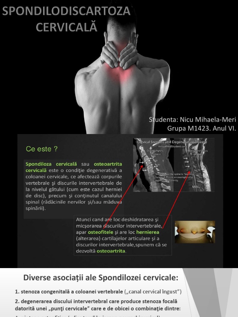 vitamine pentru restabilirea cartilajului în discul intervertebral)