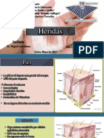 Tipos de Heridas