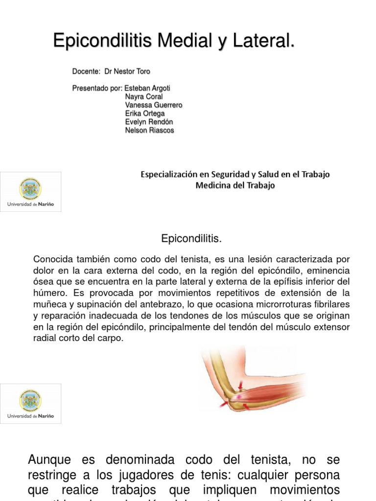 Epicondilitis Medial y Lateral: causas, síntomas y tratamiento | PDF ...
