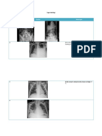 Tugas Radiologi