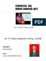 Interpretasi Ekg Pada Acs-1 PDF