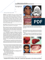 Treatment of Large Thyroglossal Duct Cyst PDF