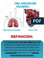 Cap. 52 Edema Pulmonar