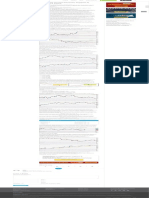 6 Indikator Krusial Penentu Support & Resistance Forex