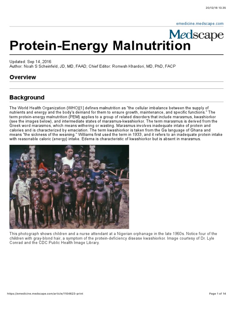 Protein Energy Malnutrition Medscape PDF Malnutrition Dermatology