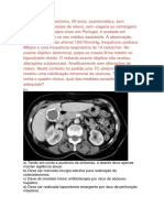 Vesícula de porcelana em doente assintomática