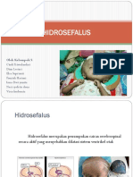 HIDROSEFALUS-1