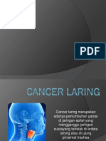 Cancer Laryng Kel Dinda