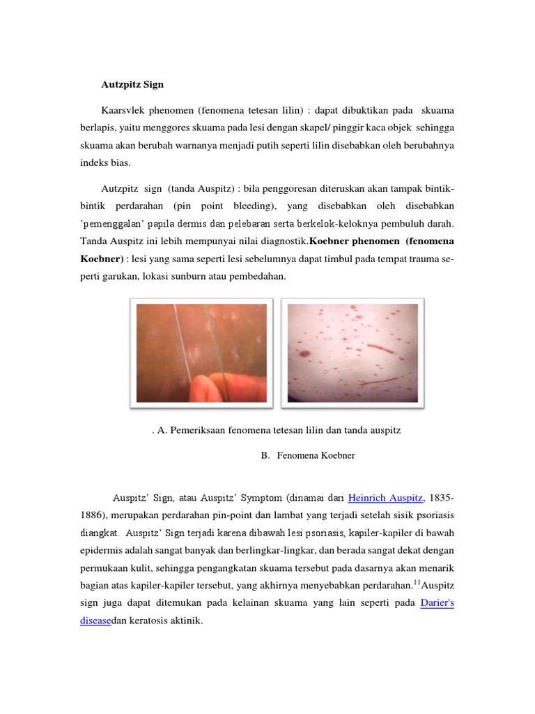 Fenomena Koebner PDF