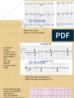 Ecg PDF