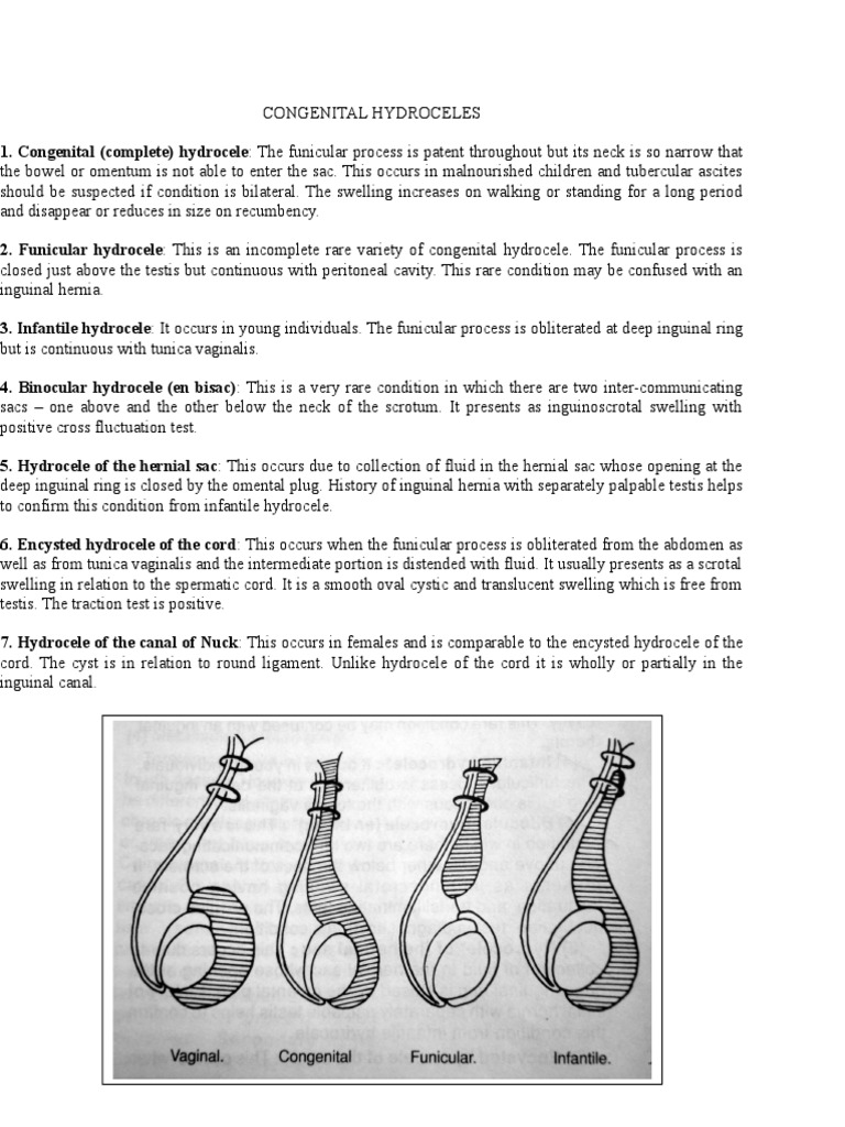 Congenital Hydroceles PDF