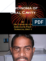 Carcinoma of Oral Cavity