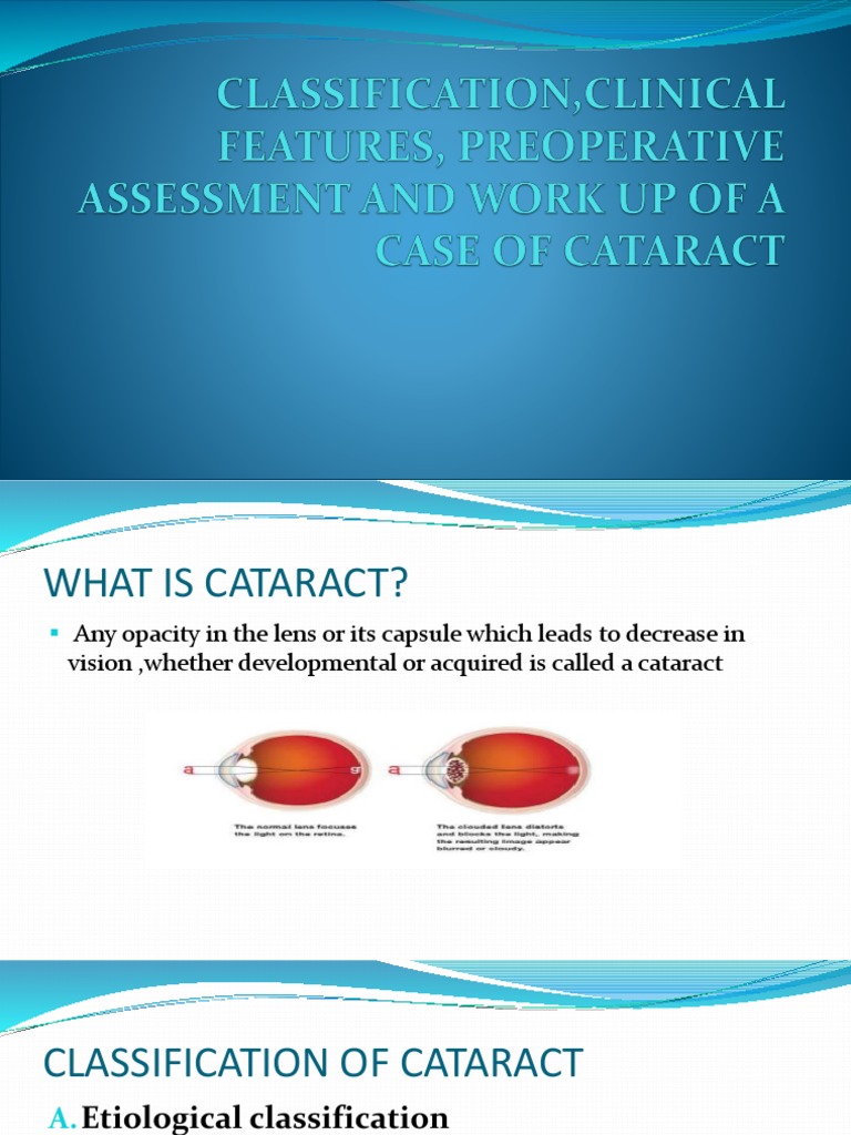 Cataract Pdf Cataract Human Eye