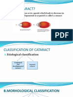 Cataract