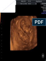 Ultrasound of A Baby