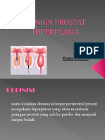 Benign Prostat Hiperplasia