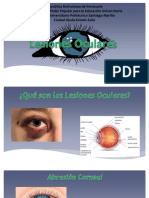 Diapositiva Lesiones Oculares