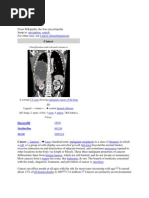 Download Cancer by mariannec_3 SN44523192 doc pdf
