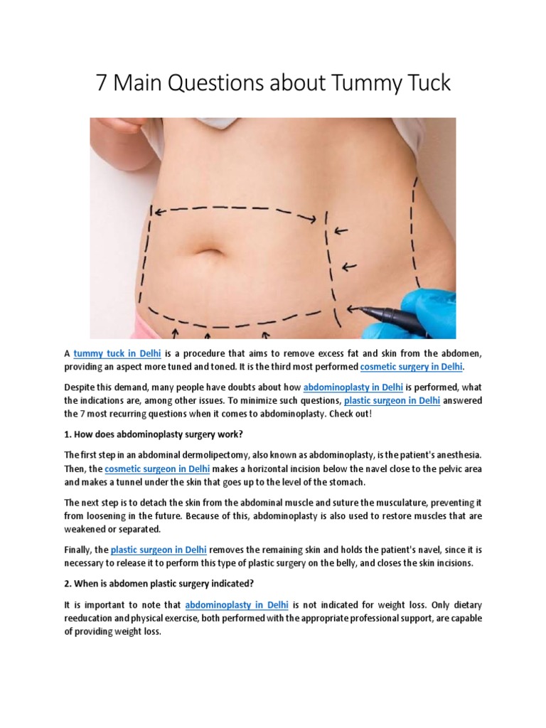 7 Main Questions About Tummy Tuck PDF Surgery Abdomen