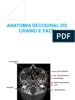 Anatomia Seccional - Cranio