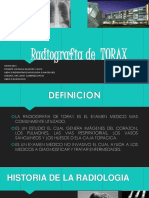 Radiografía de Tórax