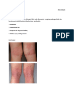 Soal OSCE Dermatitis Atopik