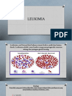 LEUKIMIA PPT.pptx