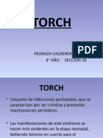 Torch Expo
