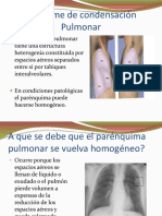 Síndrome de condensación pulmonar.ppt