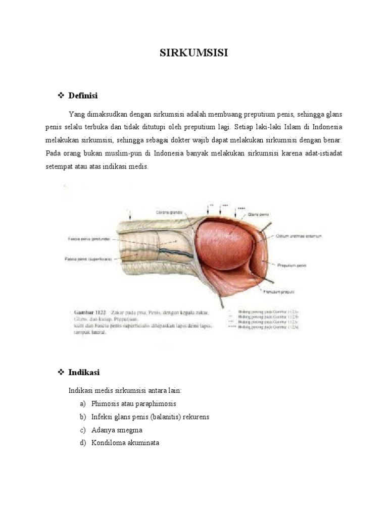 Dick ustidan eshakni silkitib
