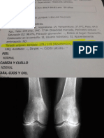 HIPERTENSION Y ANALGESIA.pptx