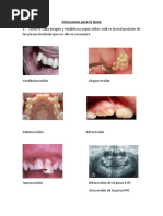 Clasificacion de Lisher | PDF