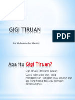 Gigi Tiruan