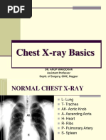 Chest X-Ray Interpretation Guide | PDF | Thorax | Lung