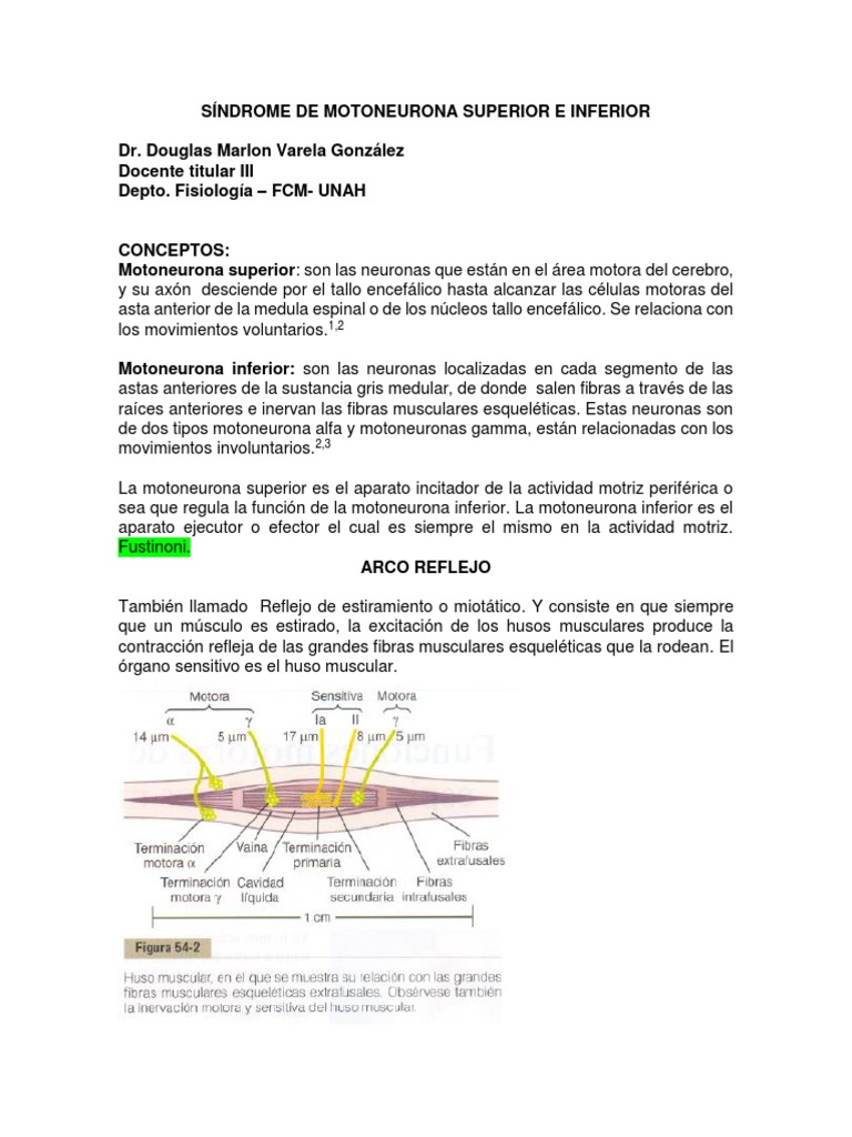 Síndrome de Motoneurona Superior e Inferior Final 2012