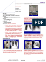 Chest Radiography