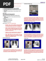 Chest X-Ray Interpretation Guide | PDF | Lung | Thorax