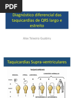 aula-8 -11h00-11h15-diagnostico-diferencial-das-taquicardias-qrs-largo-estreito-dr-alex-guabiru