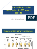 aula-8 -11h00-11h15-diagnostico-diferencial-das-taquicardias-qrs-largo-estreito-dr-alex-guabiru