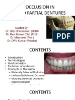 Occlusion in Fixed Partial Denture