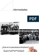Pseudoacondroplasiapdf