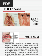 Download POLIP NASI by anggun pratissa SN44630788 doc pdf