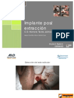 Implante Post Extraccion - C.D. Homero Tavira Jaimes